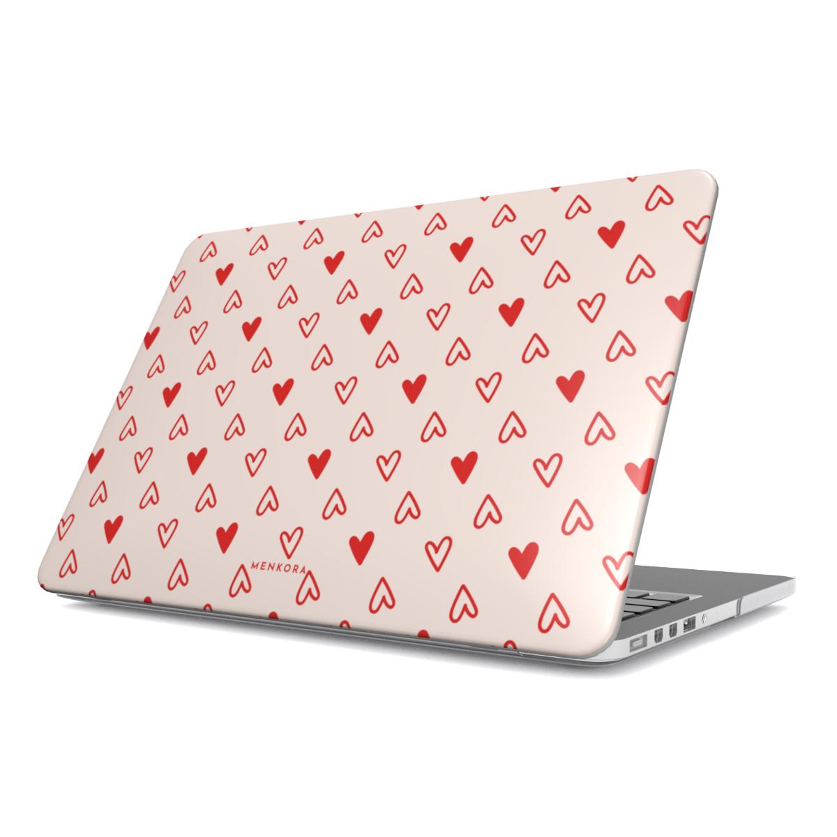 Cupid MacBook Case