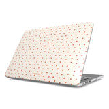 TinyLove MacBook Case
