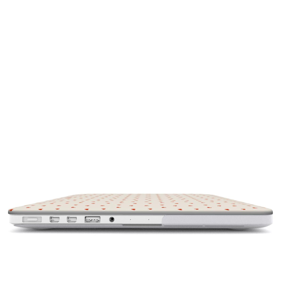TinyLove MacBook Case